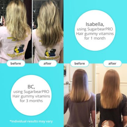 Biotin Gummy Hair Vitamins - Image 6