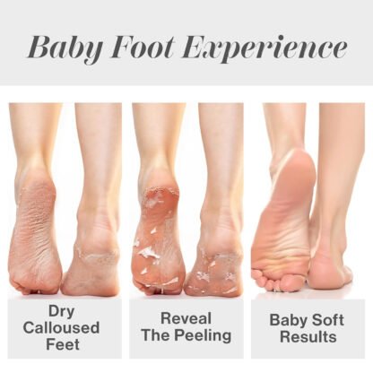 Exfoliating Foot Peel - Image 4