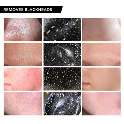 Vassoul Blackhead Remover Mask - Image 3