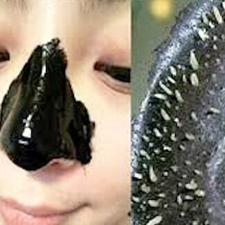 Blackhead Remover And Pore Cleanser